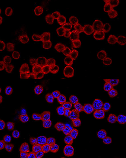 Caspase 1 Antibody in Immunocytochemistry (ICC/IF)