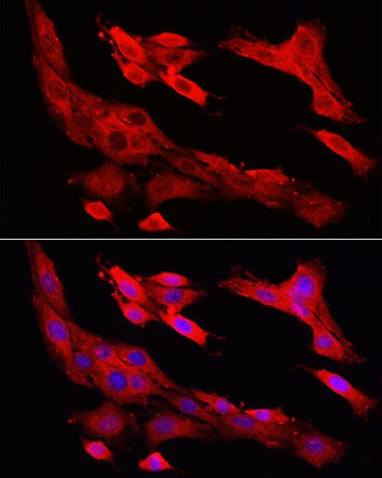 Caspase 1 Antibody in Immunocytochemistry (ICC/IF)