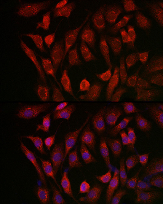 Cathepsin B Antibody in Immunocytochemistry (ICC/IF)