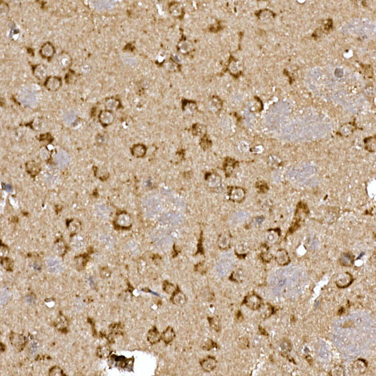 Cathepsin B Antibody in Immunohistochemistry (Paraffin) (IHC (P))