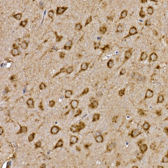 Cathepsin B Antibody in Immunohistochemistry (Paraffin) (IHC (P))