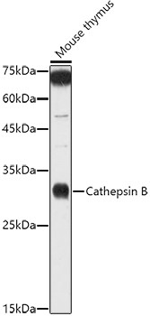 Cathepsin B Antibody in Western Blot (WB)