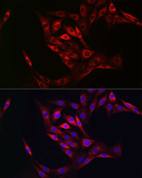 TGM2 Antibody in Immunocytochemistry (ICC/IF)