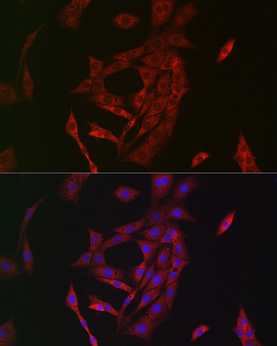 TGM2 Antibody in Immunocytochemistry (ICC/IF)