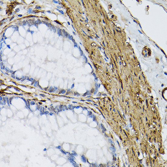 TGM2 Antibody in Immunohistochemistry (Paraffin) (IHC (P))