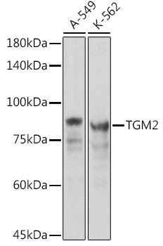 TGM2 Antibody in Western Blot (WB)