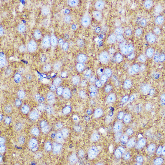 SNAP25 Antibody in Immunohistochemistry (Paraffin) (IHC (P))