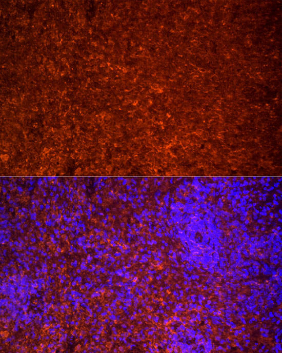 TLR7 Antibody in Immunocytochemistry (ICC/IF)