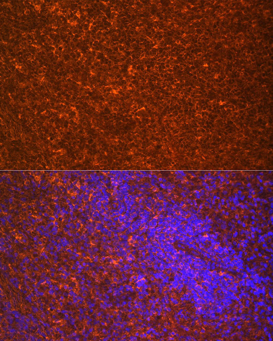 TLR7 Antibody in Immunocytochemistry (ICC/IF)