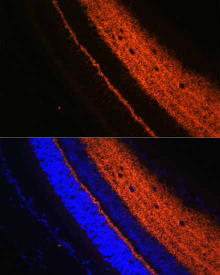 Synaptotagmin 1 Antibody in Immunohistochemistry (Paraffin) (IHC (P))