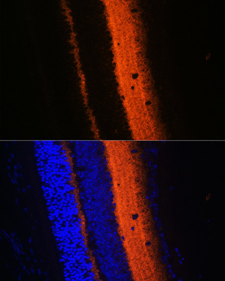 Synaptotagmin 1 Antibody in Immunohistochemistry (Paraffin) (IHC (P))