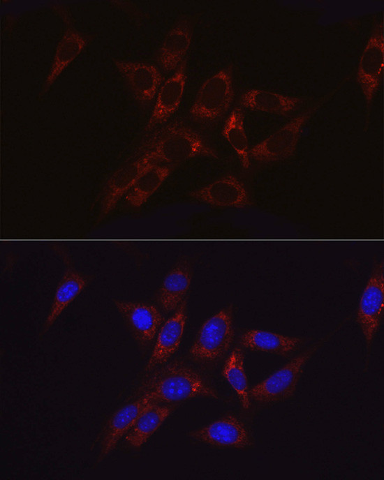 HK2 Antibody in Immunocytochemistry (ICC/IF)