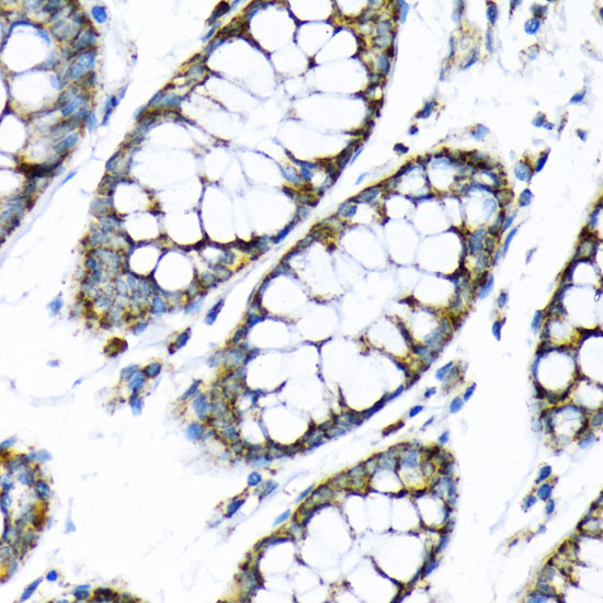 HK2 Antibody in Immunohistochemistry (Paraffin) (IHC (P))