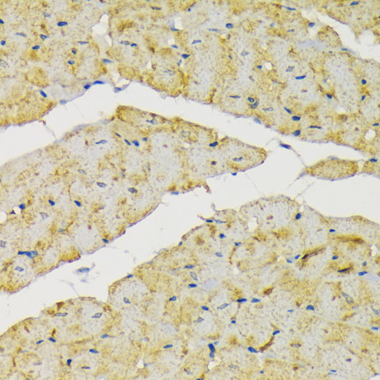 HK2 Antibody in Immunohistochemistry (Paraffin) (IHC (P))