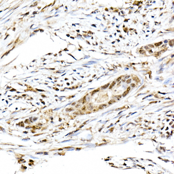 ID2 Antibody in Immunohistochemistry (Paraffin) (IHC (P))