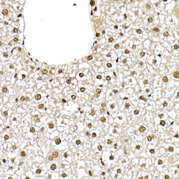 ID2 Antibody in Immunohistochemistry (Paraffin) (IHC (P))