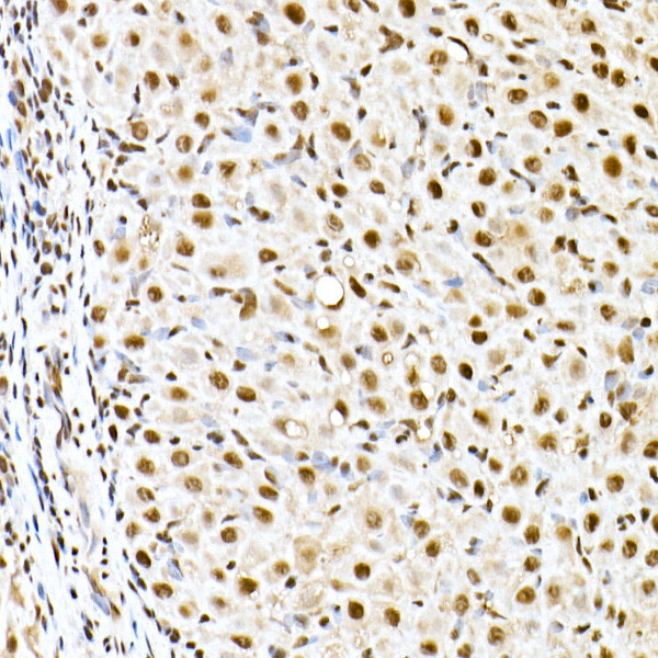 ID2 Antibody in Immunohistochemistry (Paraffin) (IHC (P))