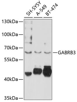 GABRB3 Antibody in Western Blot (WB)