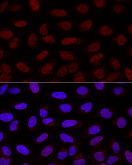 YAP1 Antibody in Immunocytochemistry (ICC/IF)