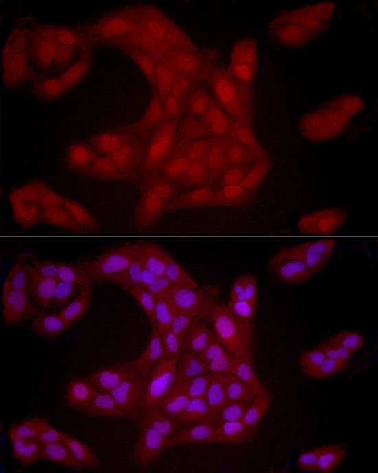 YAP1 Antibody in Immunocytochemistry (ICC/IF)