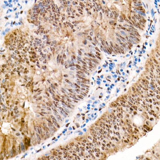 YAP1 Antibody in Immunohistochemistry (Paraffin) (IHC (P))