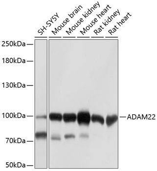 ADAM22 Antibody in Western Blot (WB)