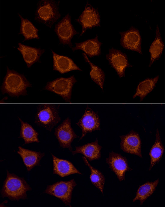 SUCLA2 Antibody in Immunocytochemistry (ICC/IF)