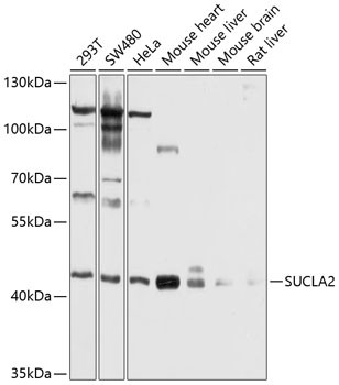 SUCLA2 Antibody in Western Blot (WB)