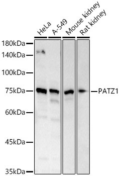 PATZ1 Antibody in Western Blot (WB)