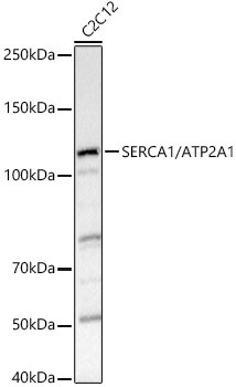 SERCA1 ATPase Antibody in Western Blot (WB)