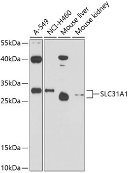 CTR1 Antibody in Western Blot (WB)