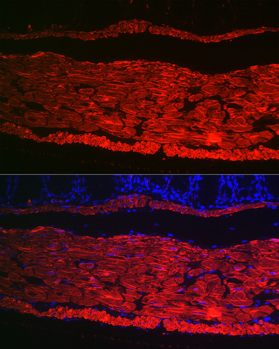 Alpha-Smooth Muscle Actin Antibody in Immunocytochemistry (ICC/IF)