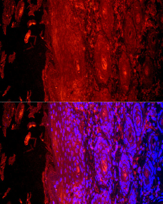 KRT9 Antibody in Immunocytochemistry (ICC/IF)