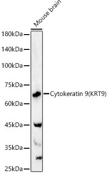 KRT9 Antibody in Western Blot (WB)