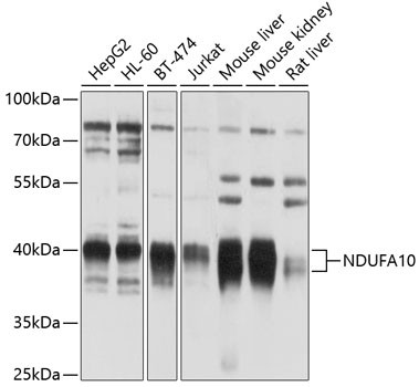 NDUFA10 Antibody in Western Blot (WB)