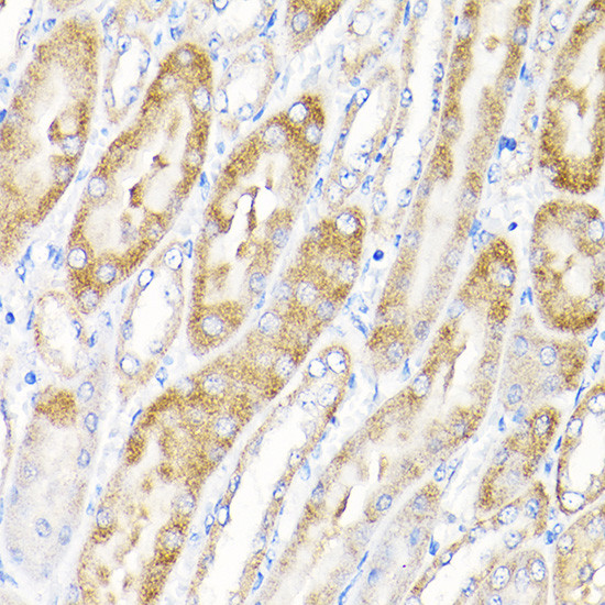 IKAP Antibody in Immunohistochemistry (Paraffin) (IHC (P))