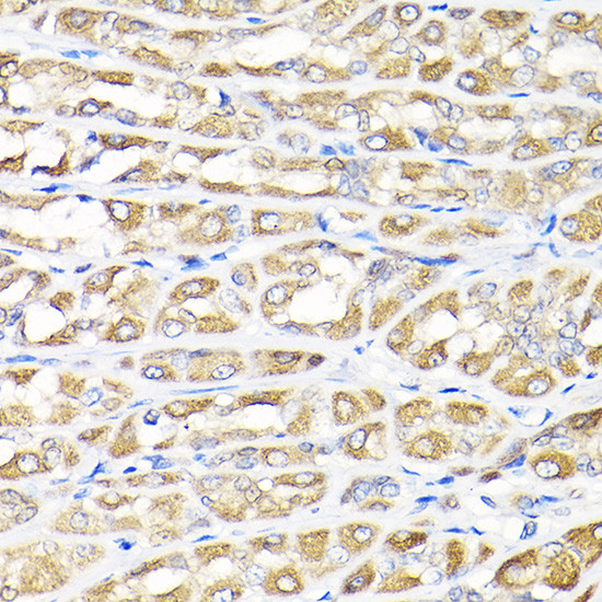 IKAP Antibody in Immunohistochemistry (Paraffin) (IHC (P))