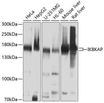 IKAP Antibody in Western Blot (WB)