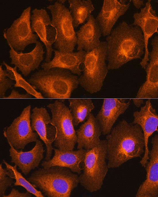 HLA-C Antibody in Immunocytochemistry (ICC/IF)