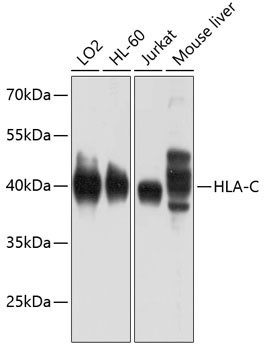 HLA-C Antibody in Western Blot (WB)