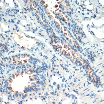 MSK2 Antibody in Immunohistochemistry (Paraffin) (IHC (P))