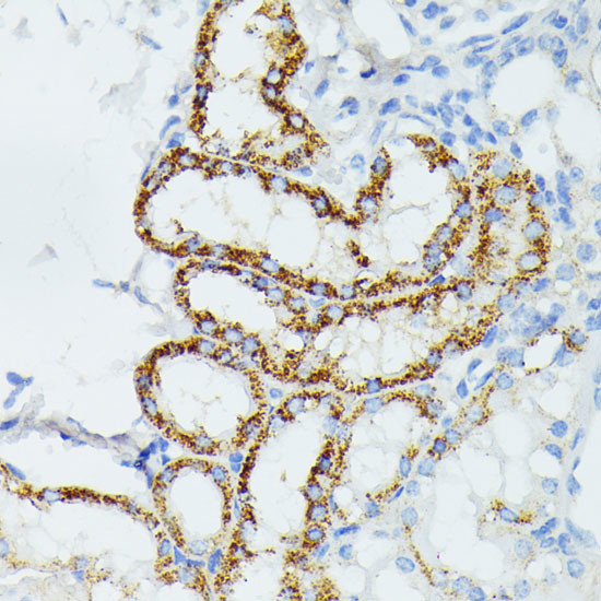 ETHE1 Antibody in Immunohistochemistry (Paraffin) (IHC (P))