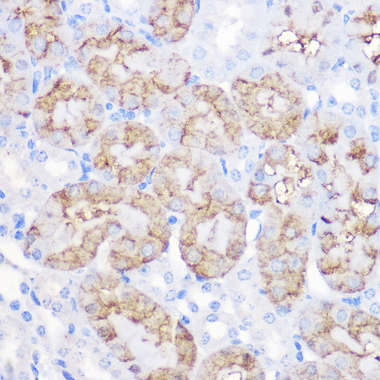 alpha-1 Antitrypsin Antibody in Immunohistochemistry (Paraffin) (IHC (P))