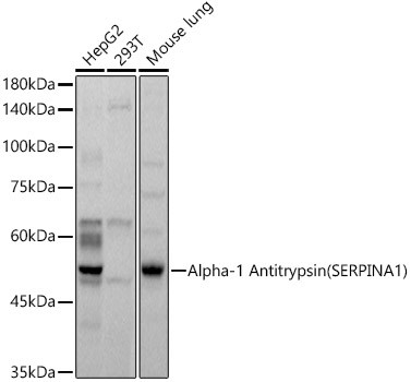 alpha-1 Antitrypsin Antibody in Western Blot (WB)