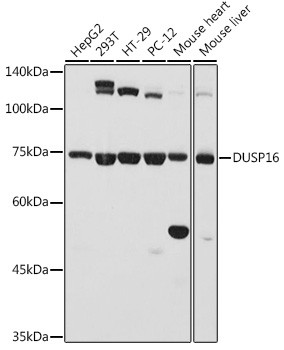 DUSP16 Antibody in Western Blot (WB)