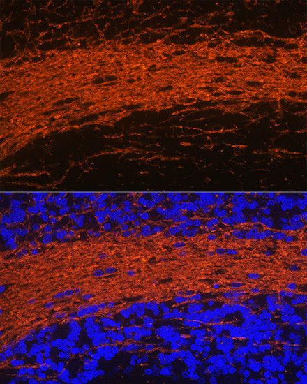 CNPase Antibody in Immunohistochemistry (Paraffin) (IHC (P))