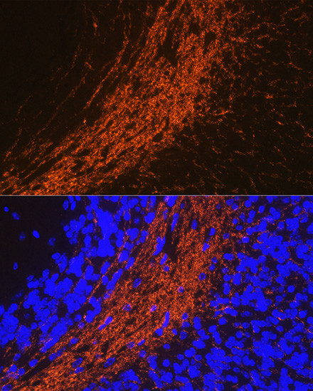 CNPase Antibody in Immunohistochemistry (Paraffin) (IHC (P))