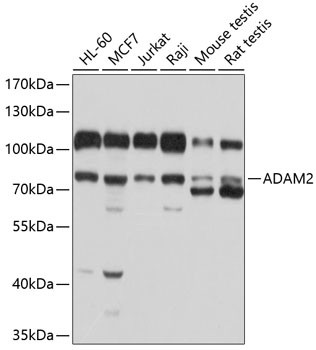 ADAM2 Antibody in Western Blot (WB)