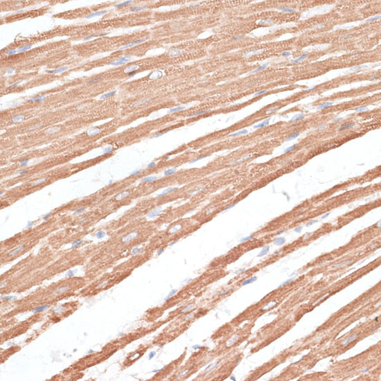 KIF4A Antibody in Immunohistochemistry (Paraffin) (IHC (P))