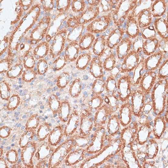 KIF4A Antibody in Immunohistochemistry (Paraffin) (IHC (P))